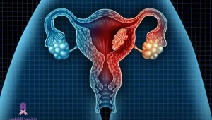جراحة أورام الرحم