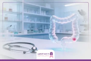 علاج أورام القولون