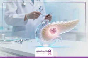 علاج أورام البنكرياس