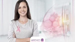 علاج أورام الثدي