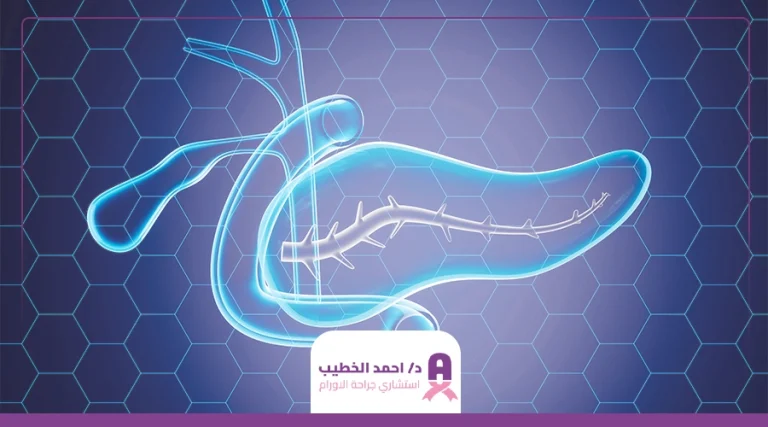 عملية استئصال ورم في البنكرياس