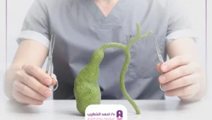 عملية استئصال المرارة