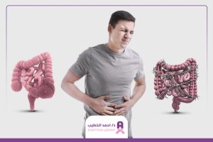 الفرق بين أعراض سرطان القولون والقولون العصبي