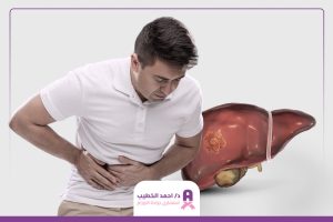 هل يشفى مريض سرطان الكبد