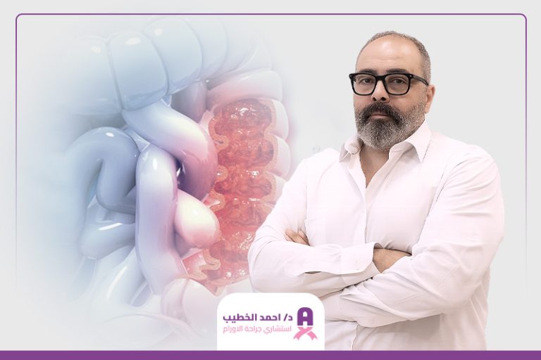 دكتور جراحة أورام القولون