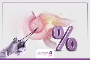 نسبة نجاح عملية استئصال ورم البنكرياس