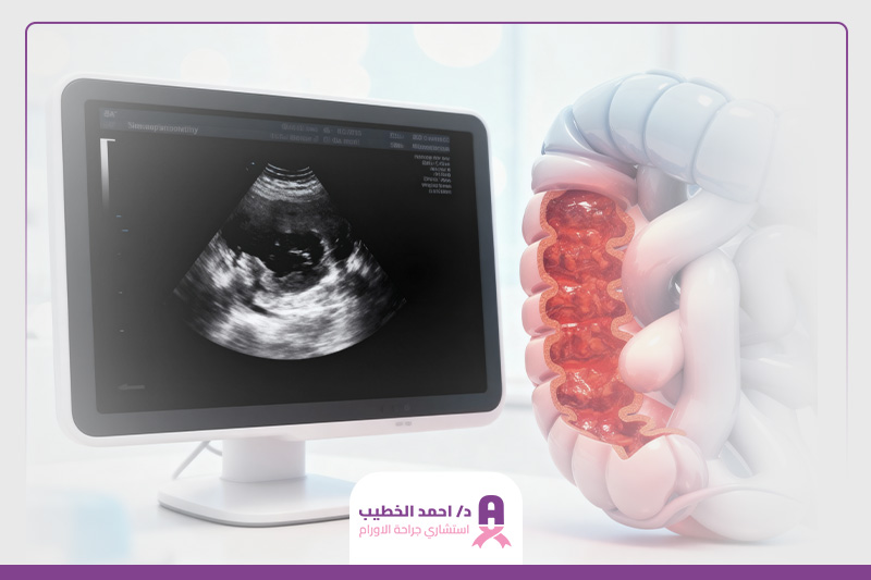 هل السونار يكشف أورام القولون الخبيثة