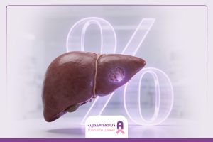 نسبة شفاء سرطان الكبد