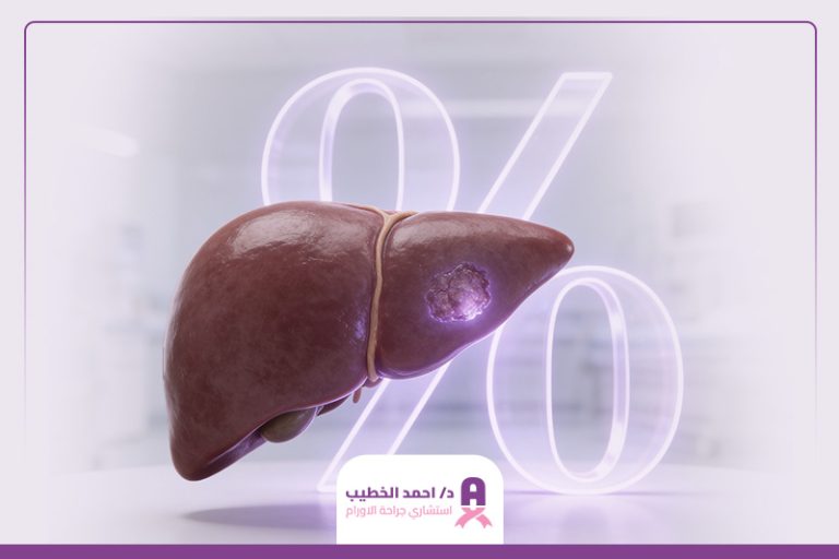 نسبة شفاء سرطان الكبد