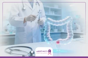 علاج أورام المستقيم