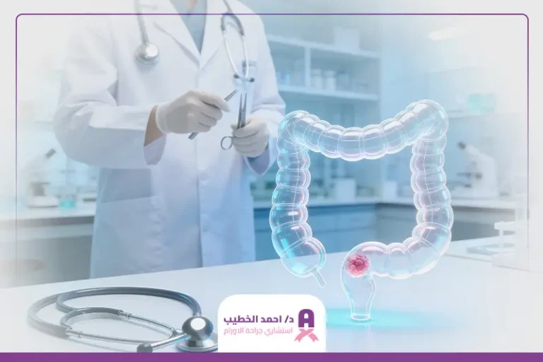 علاج أورام المستقيم