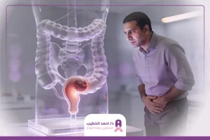 أعراض سرطان المستقيم