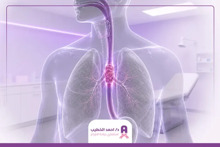 سرطان المريء