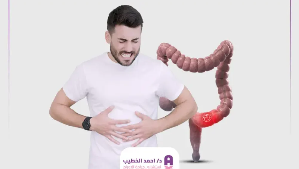 أعراض سرطان القولون في بدايته أعراض سرطان القولون في بدايته