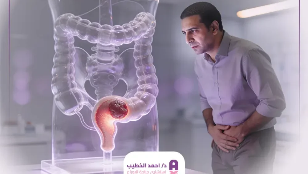 أعراض سرطان المستقيم