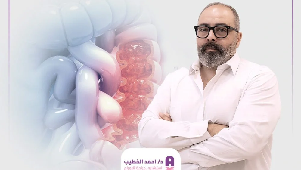 دكتور جراحة أورام القولون