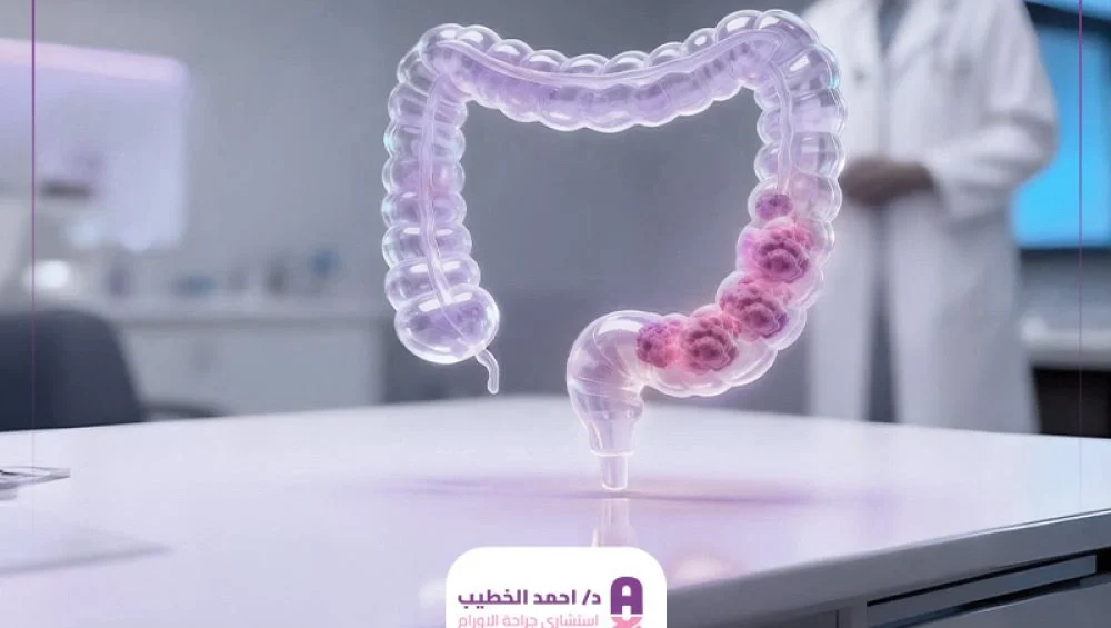 شكل ورم القولون