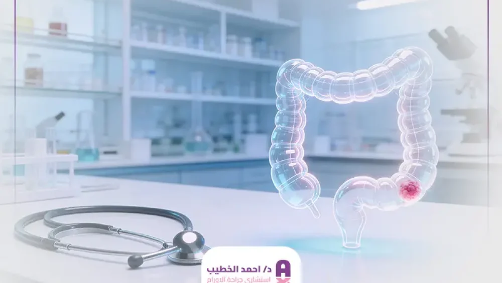 علاج أورام القولون