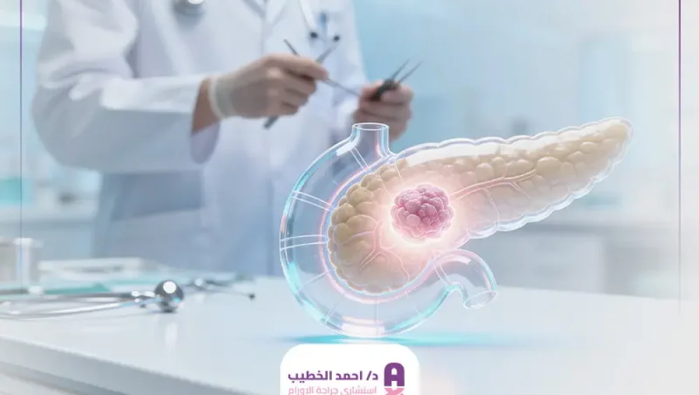 علاج أورام البنكرياس