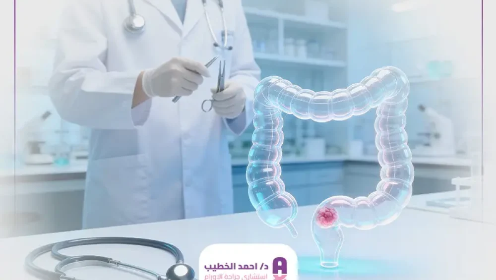 علاج أورام المستقيم