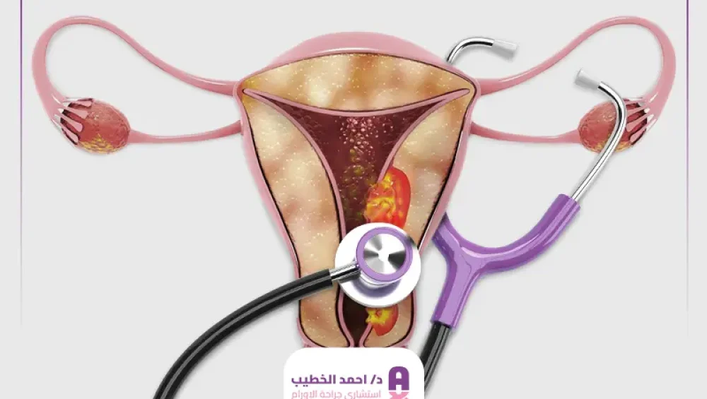 علاج سرطان عنق الرحم
