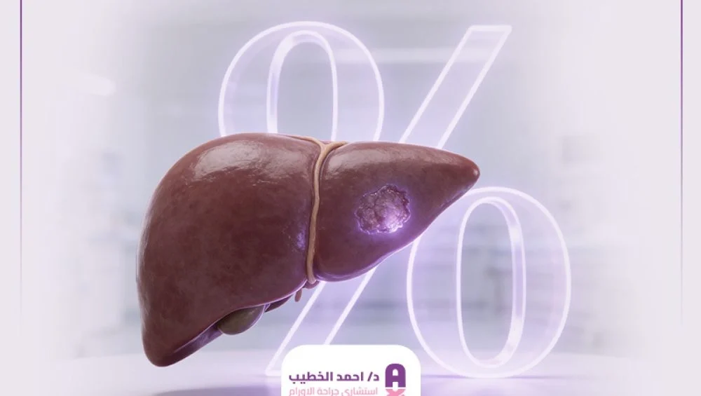 نسبة شفاء سرطان الكبد