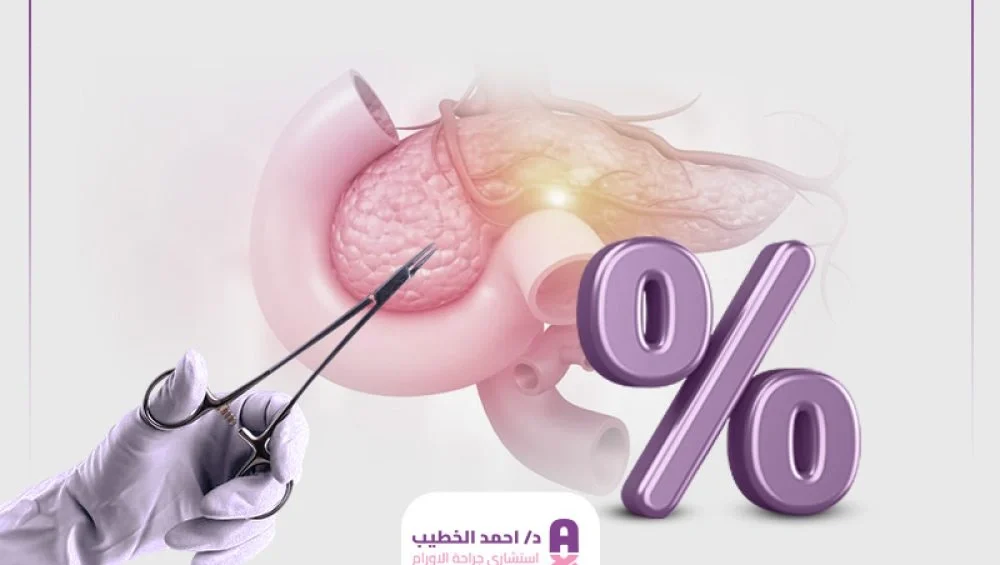 نسبة نجاح عملية استئصال ورم البنكرياس