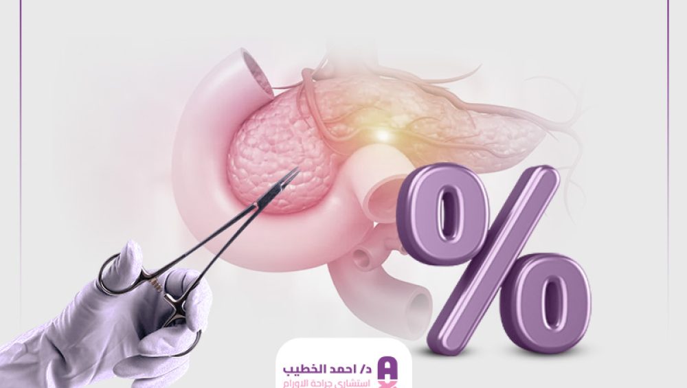 نسبة نجاح عملية استئصال ورم البنكرياس
