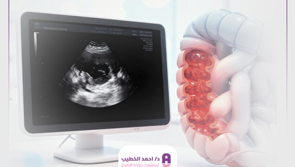 هل السونار يكشف أورام القولون الخبيثة