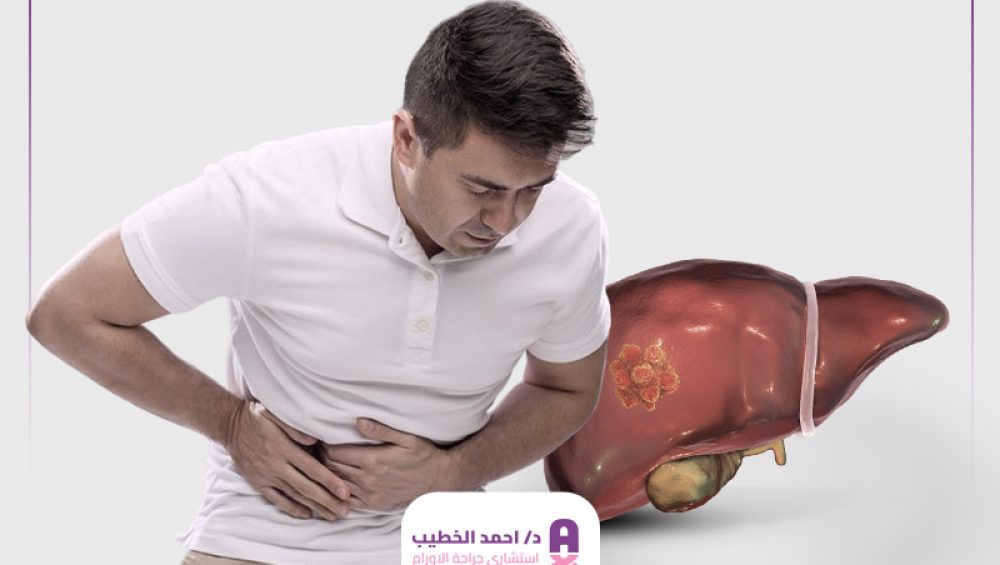 هل يشفى مريض سرطان الكبد